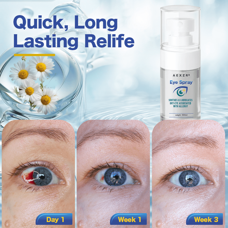 Aexzr® Gentle Eye Spray Redness Relief Treatment